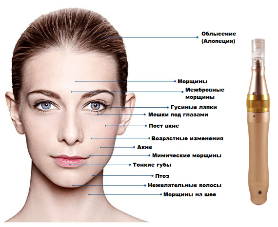 Какие проблемы решает Dr. Pen Purple Дермапен